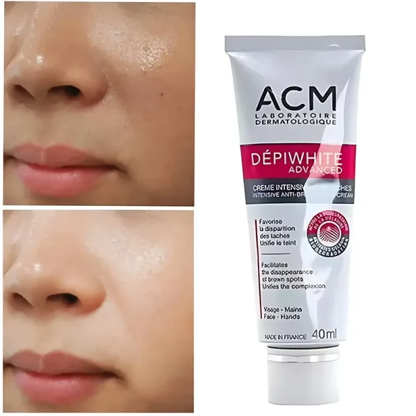 کرم ضد لک ای سی ام ACM دپی وایت اصل فرانسه حجم 40 میل